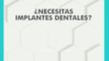 Implantes dentales - Clínica Visage