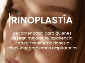 Rinoplastía - Dr. Sergio Valenzuela U