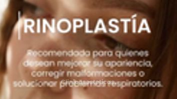 Rinoplastía - Dr. Sergio Valenzuela U