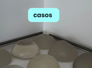Diferentes implantes mamarios - Dr. Vicente Sánchez Liberona