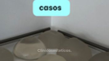 Diferentes implantes mamarios - Dr. Vicente Sánchez Liberona