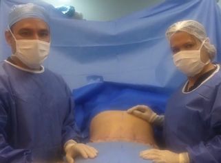 Abdominoplastia 