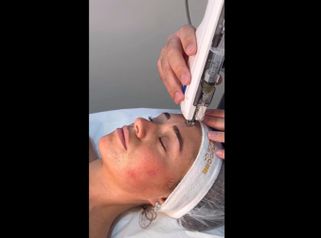 Rejuvenecimiento facial - Novavita Ltda