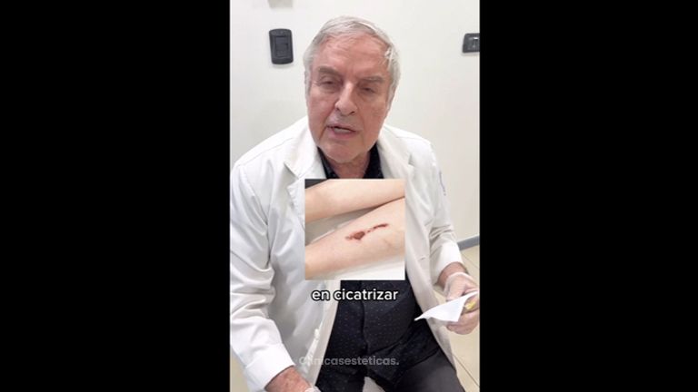 Borrar cicatrices - Dr. René Flores Aqueveque
