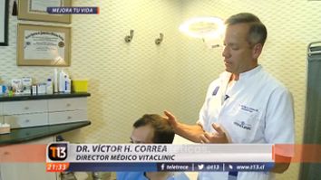 Tele13 Central - La caída del cabello tiene solución