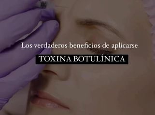 ¿Sabías que la toxina botulínica? - Dr. René Flores Aqueveque