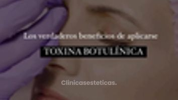 ¿Sabías que la toxina botulínica? - Dr. René Flores Aqueveque