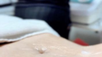 Eliminación de grasa tratamiento combinado - Amarna