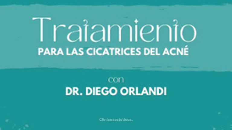 Cicatrices del acné  - Centro Médico La Cumbre