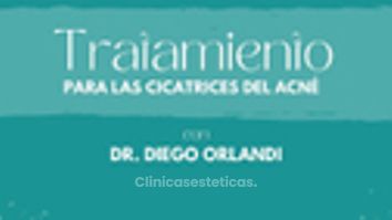 Cicatrices del acné  - Centro Médico La Cumbre