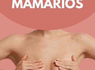 Implantes mamarios - Dra. Fernanda Deichler