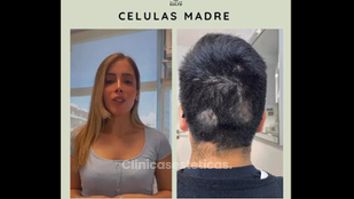 Células madre - Clínica Dra. Kelly Gulfo