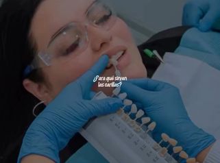 Carillas Dentales - Clinica Visage