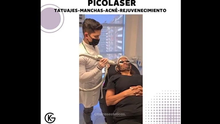 Picoláser - Clínica Dra. Kelly Gulfo