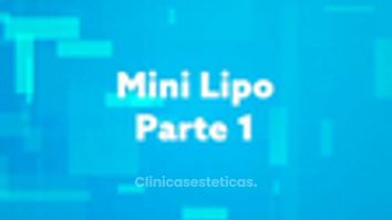 Liposucción - Dr. Claudio Silva Vergara