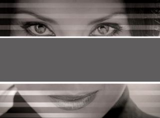 Blefaropastia - Doctor Patricio Stevens Moya