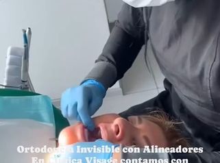 Ortodoncia invisible - Clínica Visage