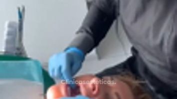 Ortodoncia invisible - Clínica Visage