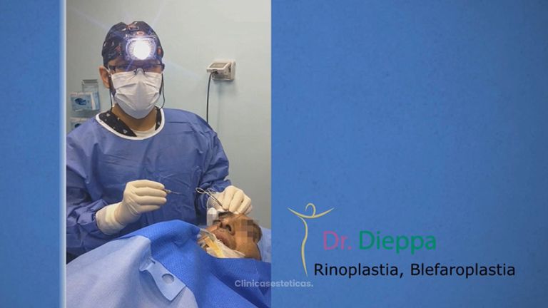 Rinoplastia+blefaroplastia + levantamiento de cejas (masculino) - Cirugía Plástica Dieppa