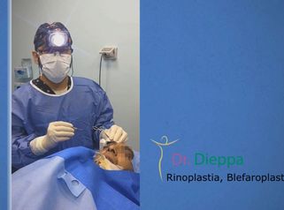 Rinoplastia+blefaroplastia + levantamiento de cejas (masculino) - Cirugía Plástica Dieppa