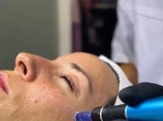 Rejuvenecimiento Facial - Amarna