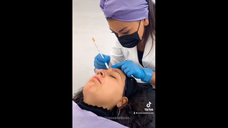 Rinomodelación - Medicina Estética Integral MD