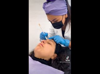 Rinomodelación - Medicina Estética Integral MD