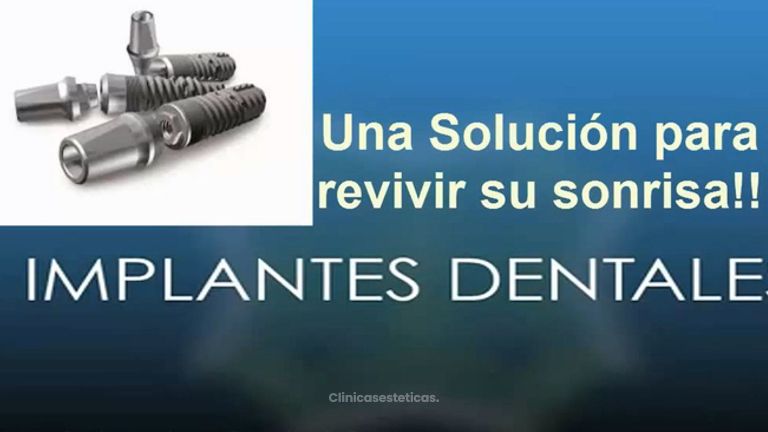 Implantes dentales de Titanio 