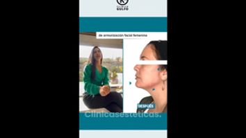 Armonización facial - Clínica Dra. Kelly Gulfo