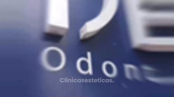 Implantes dentales - IDENTAL