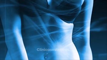 Prótesis Mamaria - Doctor Patricio Stevens Moya