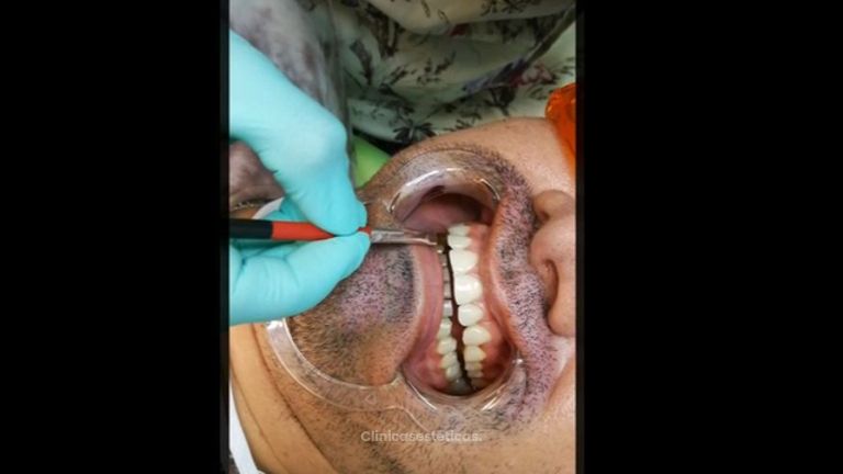 Salud oral y Estética Facial