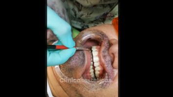 Salud oral y Estética Facial